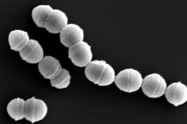 ¡Alerta en Japón! Más de 1,100 casos de infección por ‘bacteria come-carne’ _Alerta_en_Japo_n__Ma_s_de_1_100_casos_de_infeccio_n_por__bacteria_come_carne_