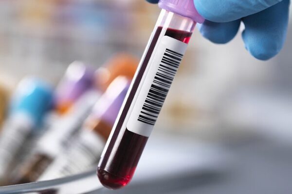 CHINADA_se_pronuncia_en_contra_de_las_acusaciones_de_dopaje_de_USADA___