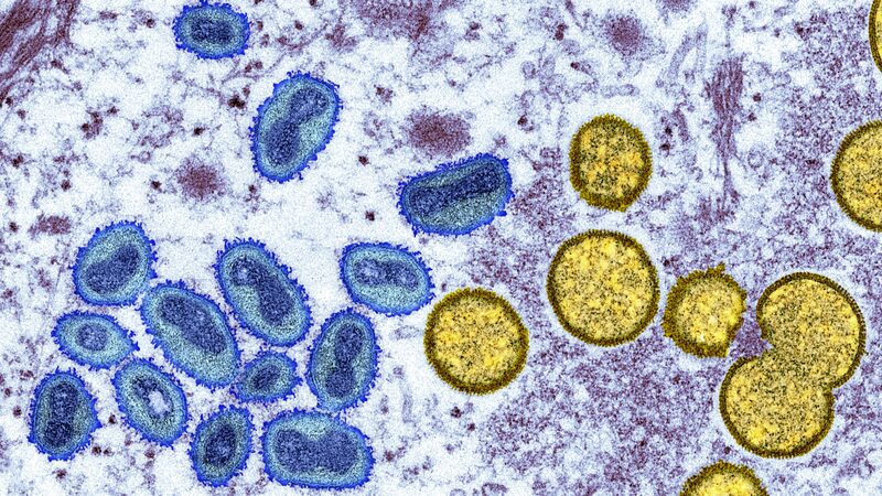 DRC_declara__Emergencia_Continental__mientras_el_brote_de_Mpox_cobra_ma_s_de_570_vidas__