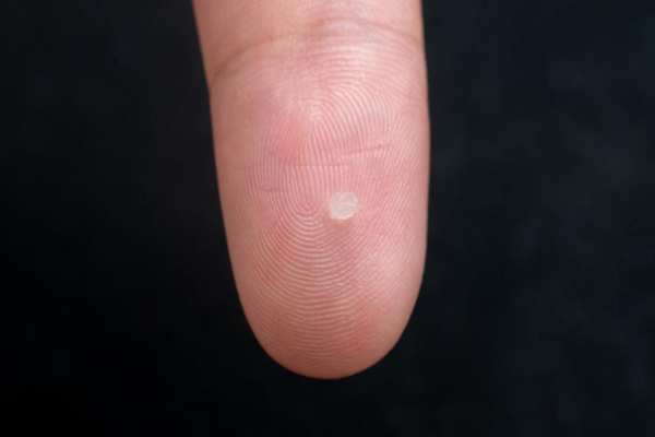 🚀 Investigadores chinos desarrollan sensores de gel inyectable que revolucionan el monitoreo cerebral 🧠 __Investigadores_chinos_desarrollan_sensores_de_gel_inyectable_que_revolucionan_el_monitoreo_cerebral__