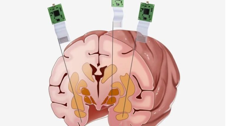 La_sonda_de_alta_tecnologi_a_de_China_para_el_cerebro_causa_impacto_en_la_neurociencia__