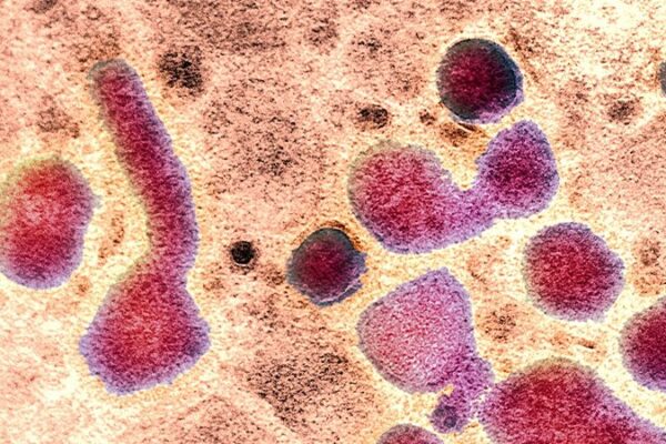 Mutación en virus H5N1 de vacas facilita infección humana, según estudio Mutacio_n_en_virus_H5N1_de_vacas_facilita_infeccio_n_humana__segu_n_estudio