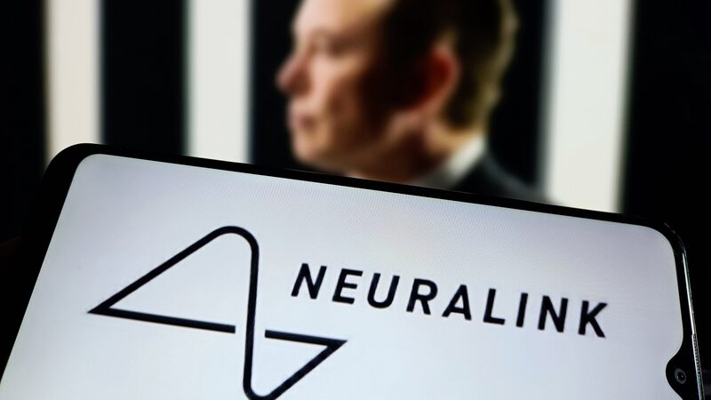 Neuralink_recibe_aprobacio_n_en_Canada__para_ensayos_de_implantes_cerebrales