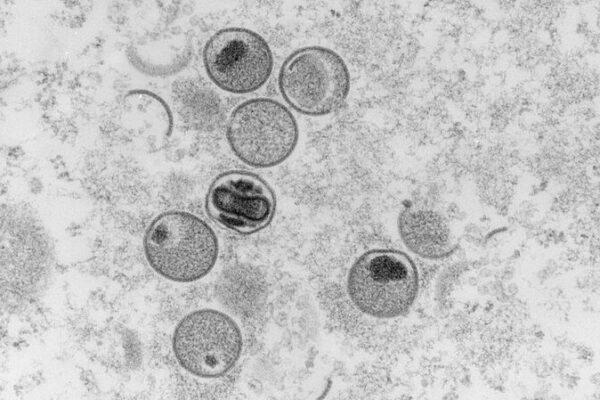 Primer_caso_de_Mpox_en_Jordania_en_2024__lo_que_necesitas_saber