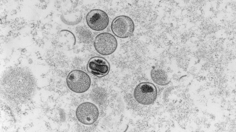 Primer_caso_de_Mpox_en_Jordania_en_2024__lo_que_necesitas_saber