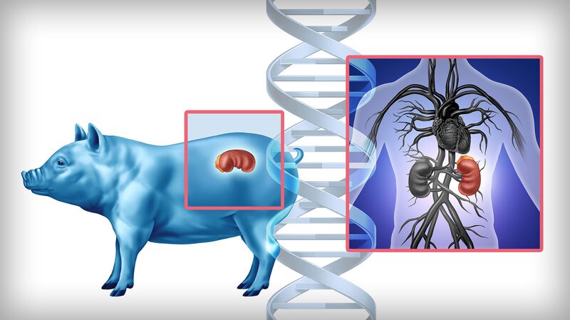 Trasplante_de_Rin_o_n_de_Cerdo_a_Humano_Desata_un_Avance_Me_dico