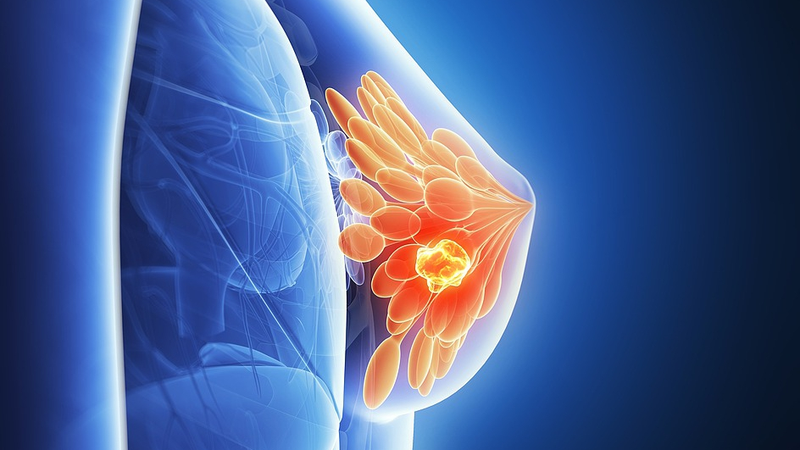 El sueño del cáncer revelado: Nuevas esperanzas para el tratamiento