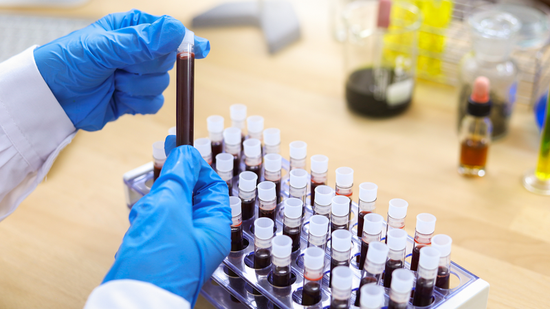 Terapia génica revolucionaria para la Hemofilia B en la China Continental