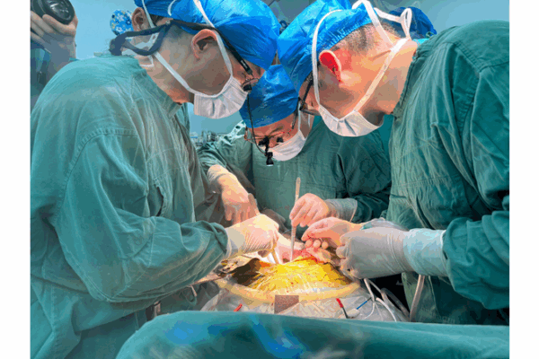 Primer trasplante de hígado de cerdo editado genéticamente mantiene vivo al paciente durante 171 días