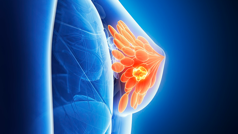 Cómo la Lactancia Materna Reprograma las Células Inmunes para Prevenir el Cáncer de Mama Agresivo