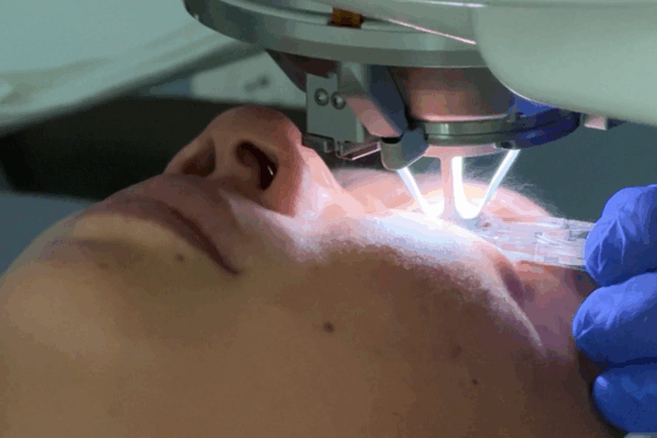 IA revoluciona la cirugía LASIK: más rápida, segura y precisa video poster
