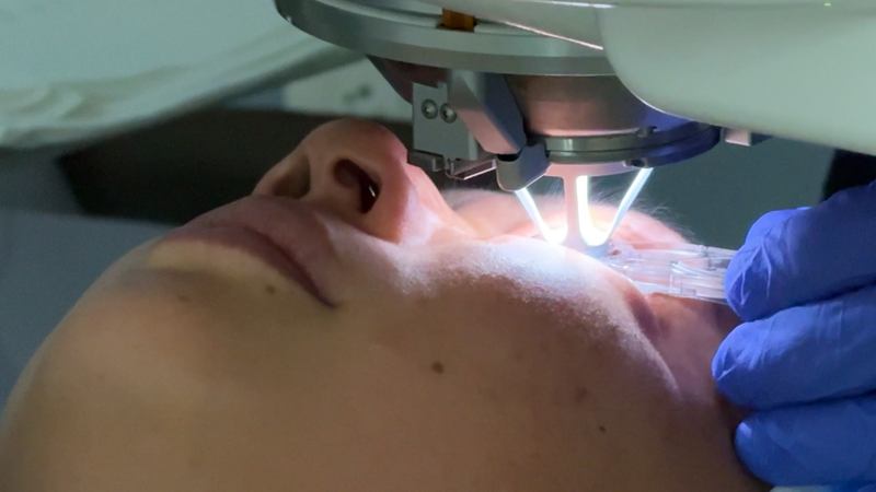 IA revoluciona la cirugía LASIK: más rápida, segura y precisa video poster